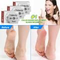 Corn Plane Blades, Double Razor Blades, 100 Pieces Replacement for Pedicure Corn Planes and Callus Shavers (Blades Only), Stainless Steel Foot Callus Remover Blades for Men and Women. 