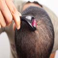 Skin Therap 0.5 Derma Roller With 540 Micro Needle. 