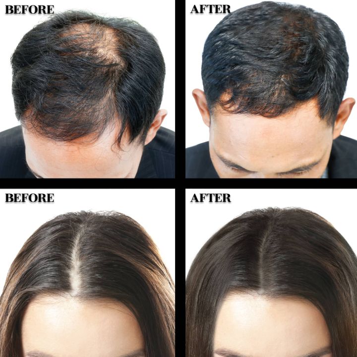 Olivia%20Instant%20Hair%20Magic%20-%20Medium%20Brown%20(Keratin%20hair%20fiber)%20-%20Image%205