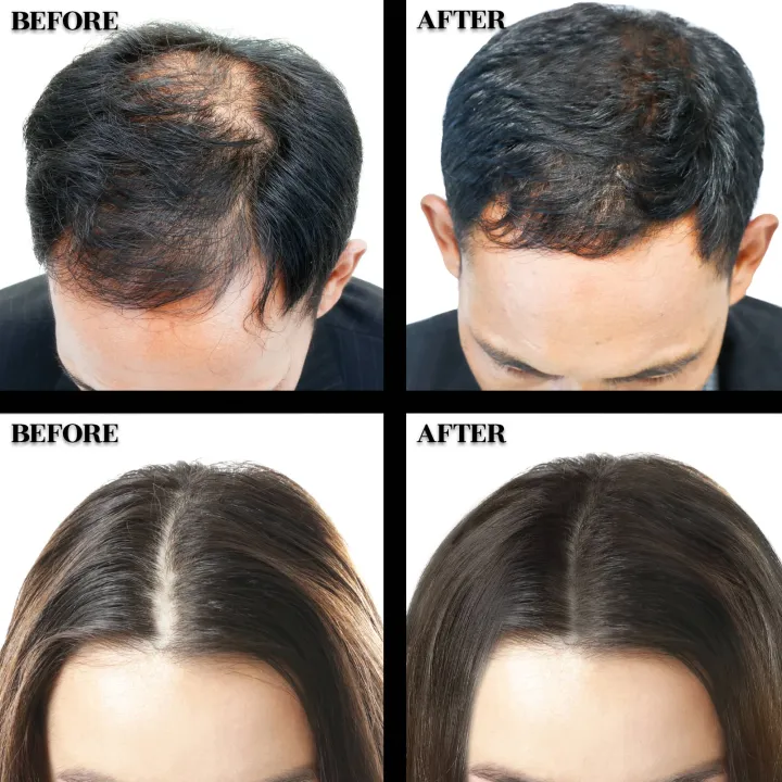 Olivia%20Instant%20Hair%20Magic%20-%20Medium%20Brown%20(Keratin%20hair%20fiber)%20-%20Image%205