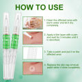 Skin Tag Removal Body Mole Wart Remover Spot Marks Wart Remover Beauty Tools professional design. 