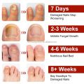 1 SOLUTION SHOP Nail Fungal Treatment Patch | Anti Fungus Toe Nail Repair Strips | Overnight Hydrogel Patch for Yellow Nails, Cracked & Brittle Nail Care | Fast Nail Restoration | 21 Patches | Anti Infection Nail Protector for Healthy Shiny Toenails. 