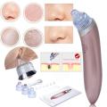Blackhead Remover Vacuum Pore Cleaner tool suction device with Rechargeable Battery - Shopznowpk. 