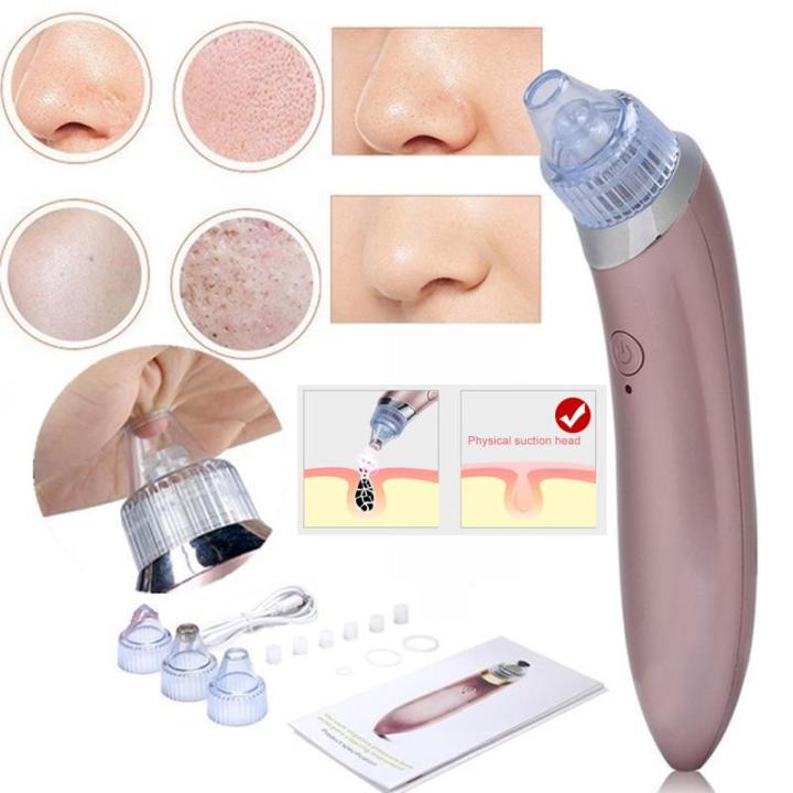 Blackhead%20Remover%20Vacuum%20Pore%20Cleaner%20tool%20suction%20device%20with%20Rechargeable%20Battery%20-%20Shopznowpk%20-%20Image%203