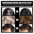 FORT  Minoxidil Hair Growth Spray - Hair Tonic for Hair Care and Hair Growth - Premium Hair Care ProductWomen and Men all Hair Types. 