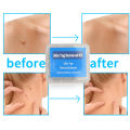 30pcs/box Body Warts Remover Ring Non-Toxic Acne Pimple Treatment Kits Wart Treat Tool for Men Women Beauty Health Care. 