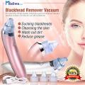 100% High Quality Electric Blackhead Acne Oil Remover Vacuum Suction Face Pore Cleaner Facial Blackhead Removal Machine. 