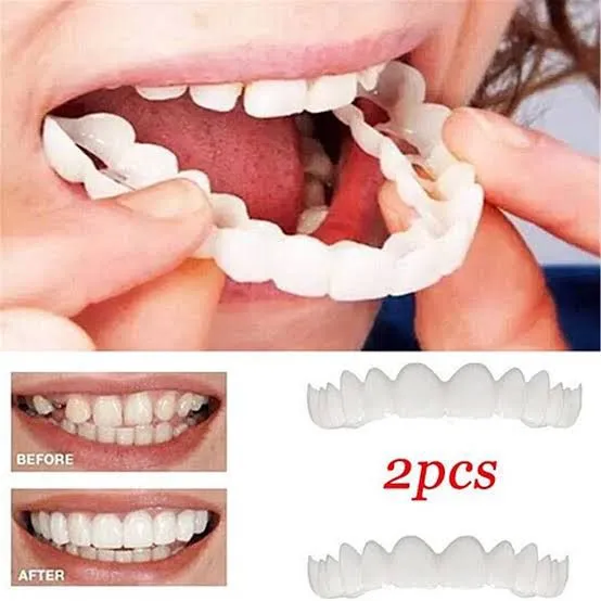 Snap-On%20Smile%20Teeth%20Veneers%20%7C%20Instant%20Whitening%20Tooth%20Cover%20for%20Men%20&%20Women%20%7C%20Reusable%20Cosmetic%20Denture%20for%20Confident%20Smile%20%7C%20Fake%20Teeth%20Veneers%20Kit%20(1Pair)%20-%20Image%203