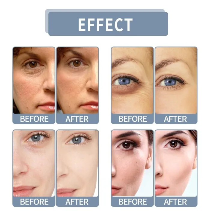 UPTOWN%20LA%20Hydro%20Boost%20Hyaluronic%20Acid%20Hydrating%20%20Cream%20Daily%20Face%20Moisturizer%20for%20%20Boosting%20Skin%20glow%20&%20Elasticity%20-%20Image%203