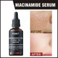 FORT Niacinamide 10 % and Zinc 1% PCA Radiance Boost Serum Formula for Clear and Glowing Skin. 