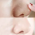 10pcs Nose Blackhead Remover Strips Mask Skin Care Shrink Pore Acne Treatment Mask Deep Nose Pore Cleansing Strips Black Head Remover. 