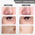 Black Head Remover Machine - Deep Face Cleanser & Pores Cleaner - Blackhead Removal Machine - Pimple Remover - Blackhead Remover - Face Cleaner Machine - Skin Scrubber for Whiteheads, Acne, and Wrinkles - Ultrasonic Face Cleaning & Lifting Device. 
