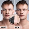 Emelie Deep Cleansing Nose Pore Strips With Charcoal (10 Strips).. 