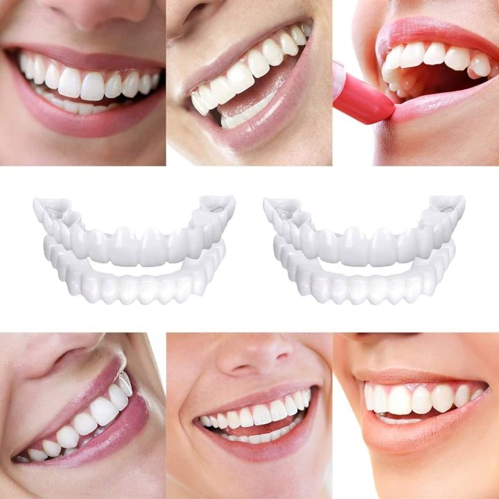 Snap-On%20Teeth%20Veneers%20for%20Upper%20&%20Lower%20%7C%20Silicone%20Fake%20Teeth%20Braces%20%7C%20Instant%20Smile%20Dentures%20-%20Image%202