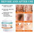 Whitening cream for dark spot removal and even complexion  Whitening cream for daily use on all skin types. 