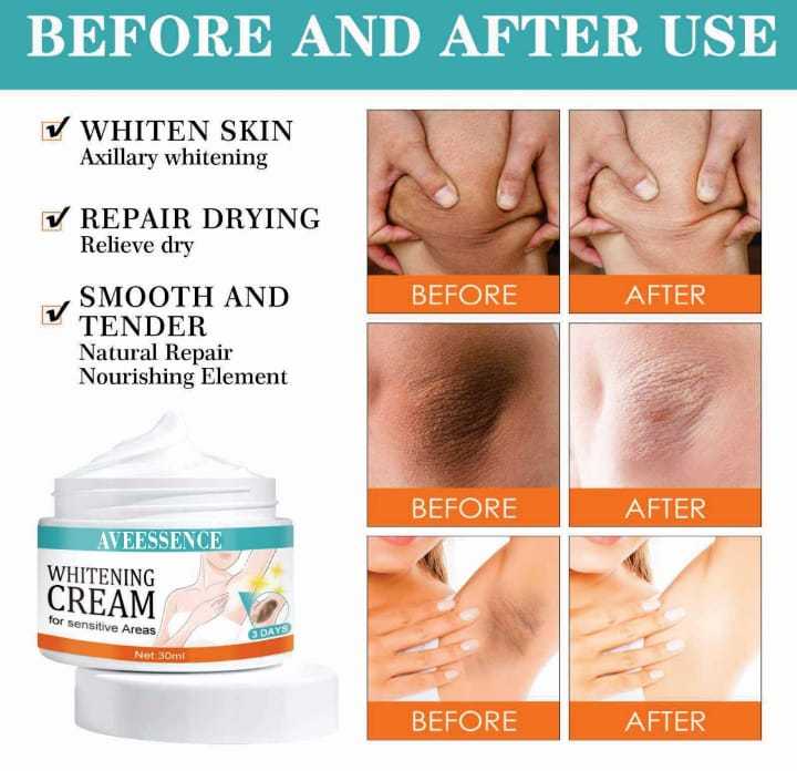 Whitening cream for dark spot removal and even complexion  Whitening cream for daily use on all skin types