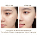 ONIZO CARE - NUTRA EFFECTS KOREAN GLASS SKIN BEAUTY CREAM GUARANTEED FAST RESULTS ONE SOLUTION FOR ACNE,DARK SPOTS,PIGMENTATION, FRECKLES & DARK SKIN (RECOMMENDED BY DERMATOLOGIST - GR.WT 50GMS). 