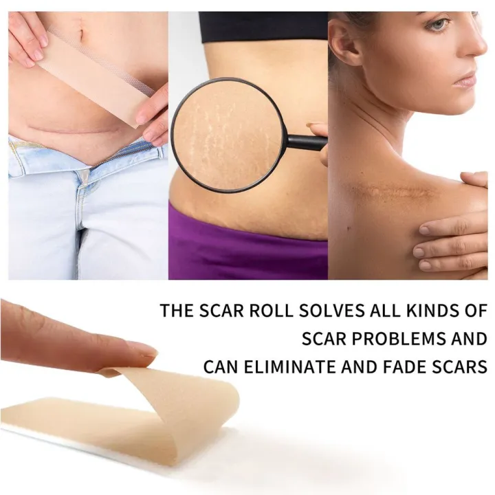 Tape%20Efficient%20Surgery%20Scar%20Removal%20Silicone%20Gel%20Sheet%20Therapy%20Patch%20-%20Image%203