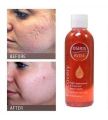 Osiris Avise Recovery Oil Helps Appearance Of Scar & Stretch Marks 100ml in Pakistan. 