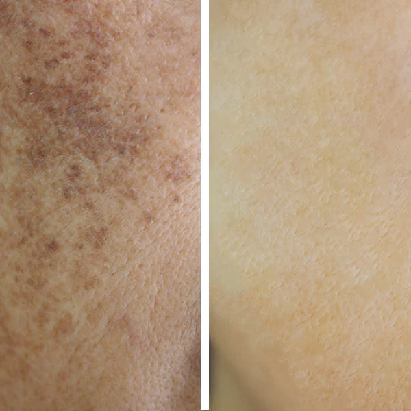 Sun%20PRO%20SC%20sunblock%20Gel%20%7C%2030g%20-%20Image%202