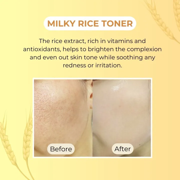 Klean%20Beauty%20Milky%20Toner%20160%20ml%20Rice%20Toner%20Face%20Cream%20Moisturizing%20Firming%20the%20Skin%20Soothing%20Repairing%20the%20Skin%20Barrier%20Toner%20Women%20Brightening%20the%20Skin%20Care-nourishes%20the%20skin,shrink%20pores%20-%20Image%205