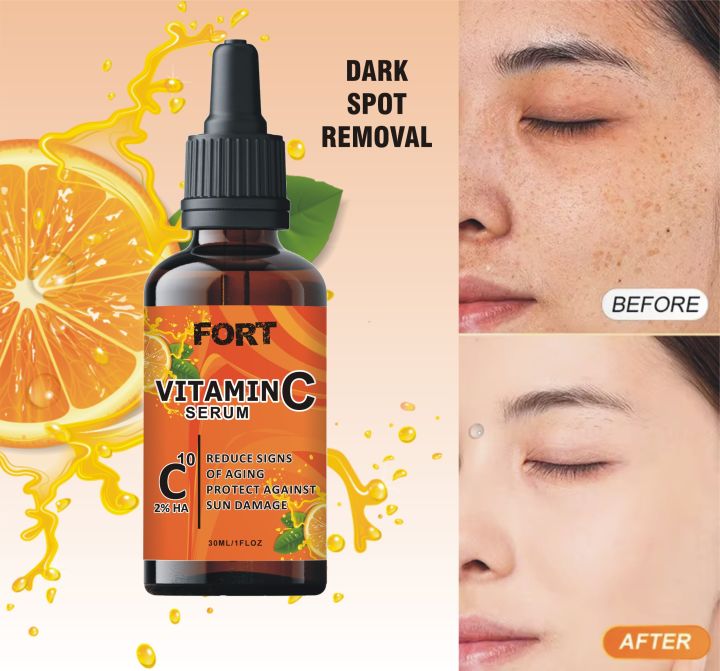 FORT Vitamin C Serum for Face - Anti-Aging, Dark Spot Correcting, and Whitening Serum for Glowing Skin | Glass Skin Care Products 30ML