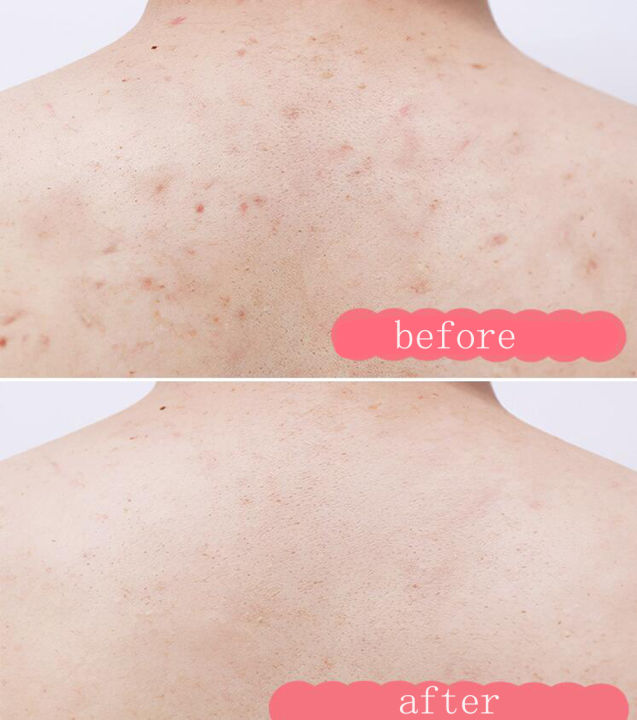 RUKI%20Body%20Scrub%20Fruity%20Exfoliate%20Body%20Hand%20Foot%20Scrub%20Deep%20Cleansing%20Scrub%20for%20Body%20-%20Image%204