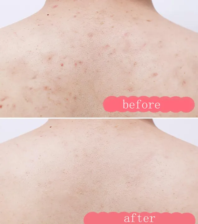 RUKI%20Body%20Scrub%20Fruity%20Exfoliate%20Body%20Hand%20Foot%20Scrub%20Deep%20Cleansing%20Scrub%20for%20Body%20-%20Image%204