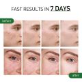 JoyPrettyin Herbal Acne Treatment Face Cream Pimple Scar Remove Oil Control Moisturizing Facial Skin Care Cream Cosmetic Beauty. 