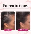 Viviscal Women's Hair Growth Supplements 180 Tablets | Clinically Proven | For Thicker, Longer Hair | Biotin & Keratin | 3-Month Supply | Best Price in Pakistan. 