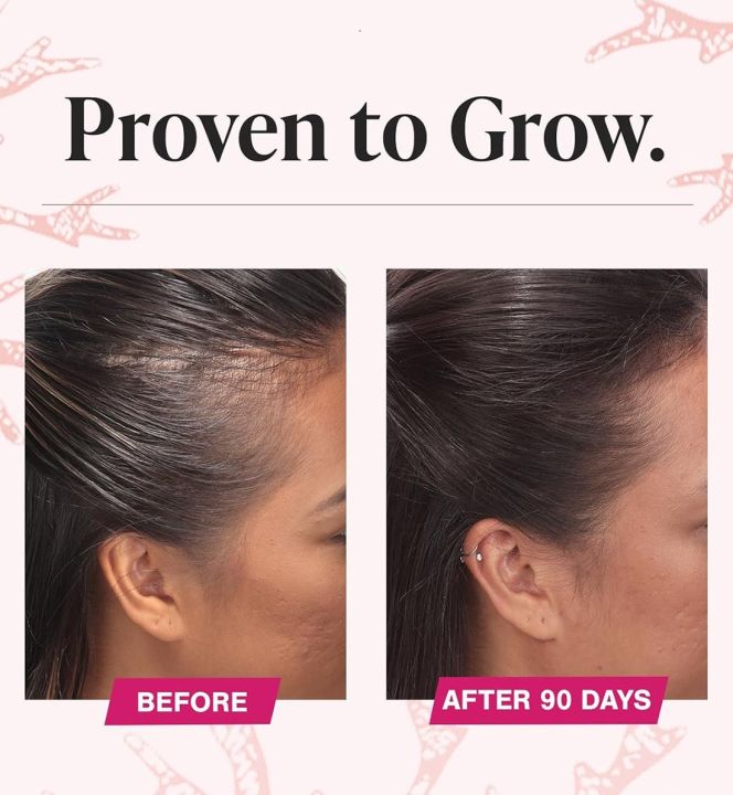 Viviscal%20Women's%20Hair%20Growth%20Supplements%20180%20Tablets%20%7C%20Clinically%20Proven%20%7C%20For%20Thicker,%20Longer%20Hair%20%7C%20Biotin%20&%20Keratin%20%7C%203-Month%20Supply%20%7C%20Best%20Price%20in%20Pakistan%20-%20Image%204