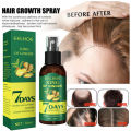 7 Days spray Hair Growth Germinal Serum Oil Natural Hair Treatment Effective Fast Growth Hair Care 30ML. 