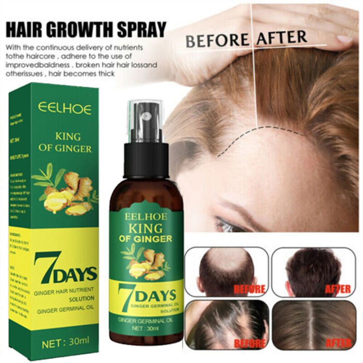 Derma%20Roller%200.5%20Mm%20Hair%20&%20Skin%20System%20with%207%20days%20ginger%20germinal%20oil%20-%20Image%206