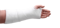 Orthoplast (Plaster Of Paris Bandage) 10cm X 2.7m. 