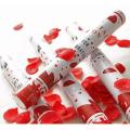 Rose Party Popper Heart Shaped Confetti Party Popper for Wedding Anniversary, Engagement ( Pack of 2). 