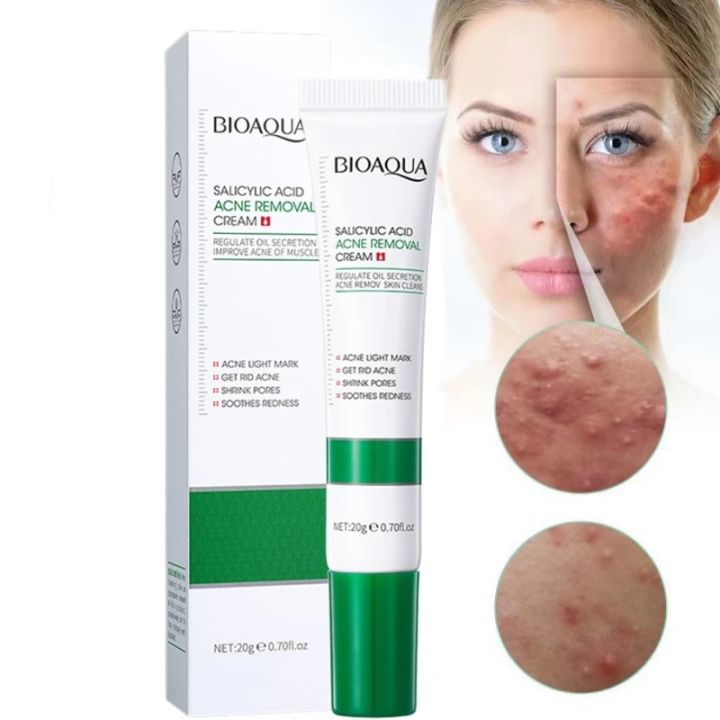 Bioaqua Salicylic Acid Acne Removal Cream - Fast Relief for Acne-Prone Skin, Reduces Redness & Acne Scars, Pimple & Blackhead Removal, Skin Clarifying, Oil-Control, Soothing Anti-Inflammatory Spot Treatment, Softening Moisturizer for Sensitive Skin, 20g