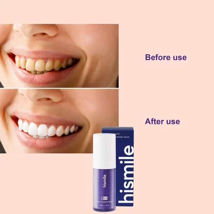 Hismile%20V34%20Toothpaste%20Original%20%7C%20Hismile%20V34%20Colour%20Corrector%20Serum%20Teeth%20%7C%20Hismile%20Teeth%20Whitening%20Kit%20%7C%20Hismile%20Toothpaste%20Purple%20%7C%20Hismile%20Original%20V34%20%7C%20Hismile%20Teeth%20Whitening%20%7C%20Hismail%20Toothpaste%20%7C%20Hismiles%20%7C%20Deep%20Smoke%20Removing%20V34%20Serum%20-%20Image%204