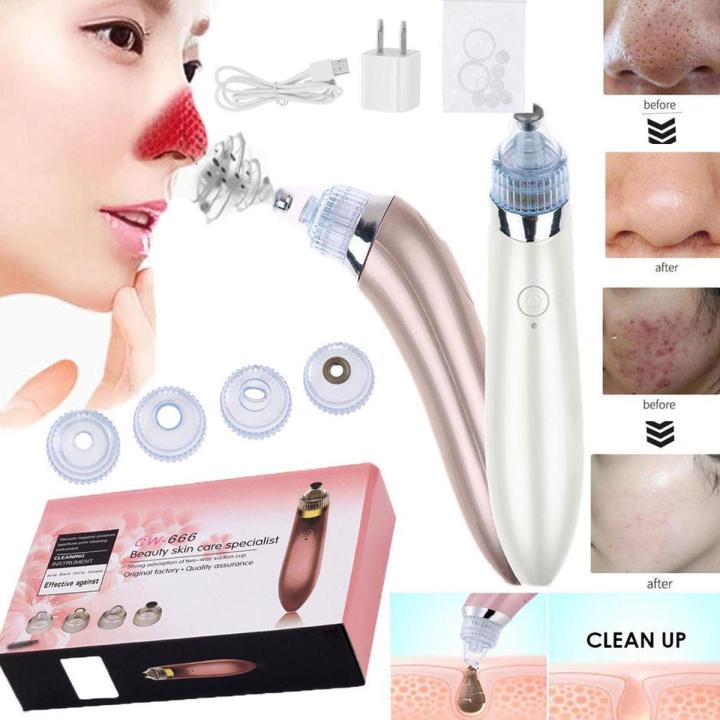 100%25%20High%20Quality%20Electric%20Blackhead%20Acne%20Oil%20Remover%20Vacuum%20Suction%20Face%20Pore%20Cleaner%20Facial%20Blackhead%20Removal%20Machine%20-%20Image%202
