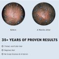 Men's ROGAINE 5% Minoxidil Solution 3 months Supply - For Hair Growth and Regrowth. 