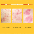 Whitening Body Cream Sulfur Ointment Scabies Mites Fat Bath Sulphur Body Wash Lotion for Itching and Sterilization 400ml. 