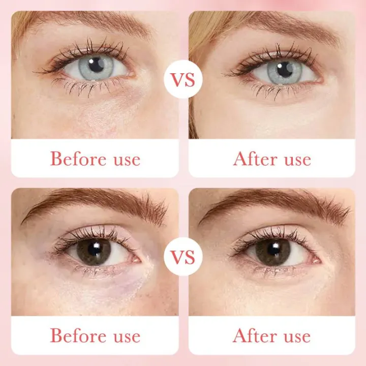 Bioaqua%20Rose%20Hyaluronic%20Acid%20Remove%20Eye%20Bags%20Eye%20Mask%2060pcs%20-%20Image%205