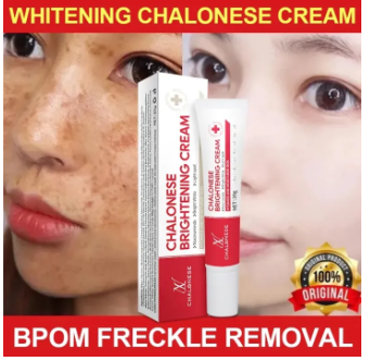 CHALONESE%20Brightening%20Cream%20Serum%2020g%20Anti%20Freckle%20Dark%20Spot%20Remover%20Skin%20Tone%20Corrector%20Glow%20Cream%20Herbal%20Gentle%20Formula%20Face%20Serum%20for%20Women%20Men%20-%20Image%205