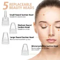 5-in-1 Blackhead remover, blackhead remover machine, derma suction, pimple acne remover, blackhead vacuum machine, dust remover, dirt remover, Pimple Popper Tool Pore Vacuum Black Head Remover, Whitehead Acne remover, deep face clean blackhead remover, fa. 
