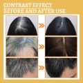 New Repair Damage Anti-Hair Sercum Gray Hair Care Serum Ebony Hair Nourishing Hair Loss Men And Women Fast Lasting Beauty Health Feeoi Freeio. 