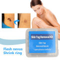 30pcs/box Body Warts Remover Ring Non-Toxic Acne Pimple Treatment Kits Wart Treat Tool for Men Women Beauty Health Care. 