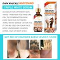 DR.DAVEY Dark Knuckle Whitening Triple White Serum - Fast Results in 7 Days | Say Goodbye to Knuckles Easily - Brightening, Moisturizing, Skin Renewal Formula. 