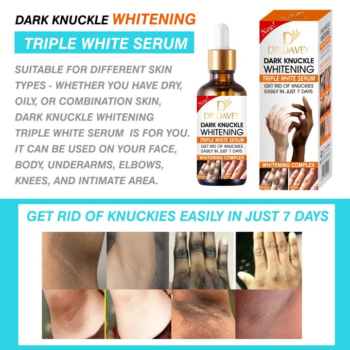 DR.DAVEY%20Dark%20Knuckle%20Whitening%20Triple%20White%20Serum%20-%20Fast%20Results%20in%207%20Days%20%7C%20Say%20Goodbye%20to%20Knuckles%20Easily%20-%20Brightening,%20Moisturizing,%20Skin%20Renewal%20Formula%20-%20Image%205