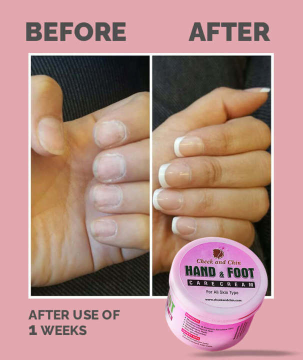 Best%20hand%20and%20foot%20cream%20Extreme%20Strong%20whitening%20mosturizer%20cream%20for%20girls%20%20foot%20hand%20cream%20Cheek%20&%20chin%20low%20price%20(100%20g%20)%20-%20Image%202