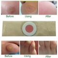 CORN CAP (Foot Care) 5PCS. 