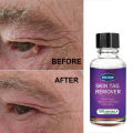 10ml/20ml/30ml/50ml Skin Tag Remover For Common And Plantar Warts Remove. 